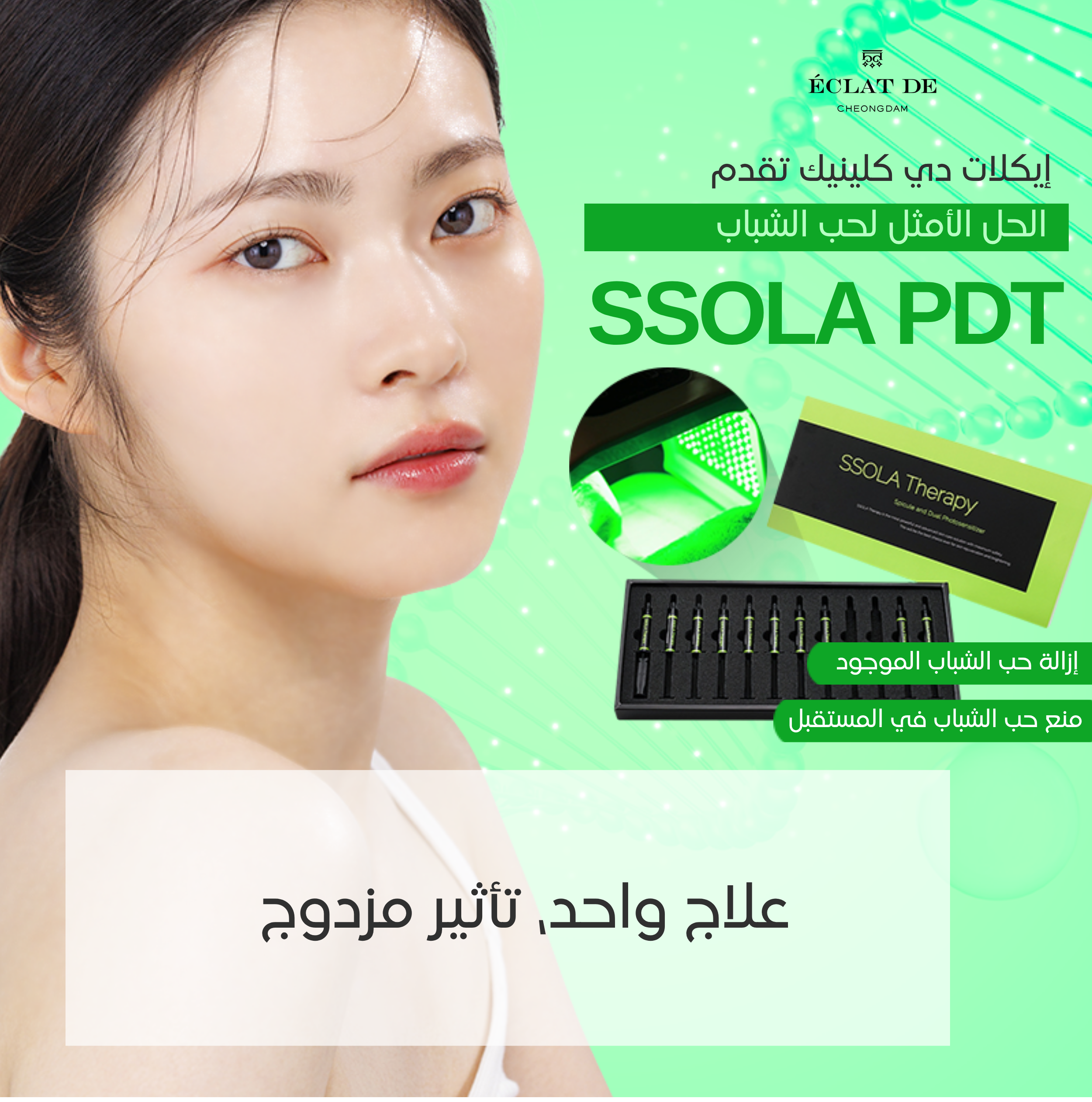 الحل النهائي لحب الشباب – SSOLA PDT