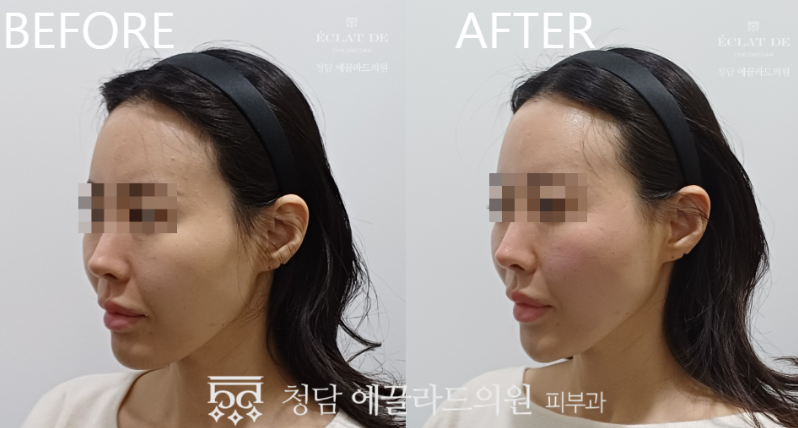  قبل وبعد – تجربة إمفيس في إيكلات دي