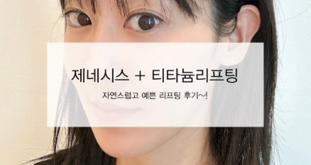 مزيج التيتانيوم ليفتينغ + ليزر جينيسيس – تجربة شخصية مدفوعة