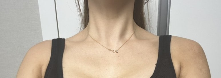 مراجعة بوتوكس الجسم Xeomin