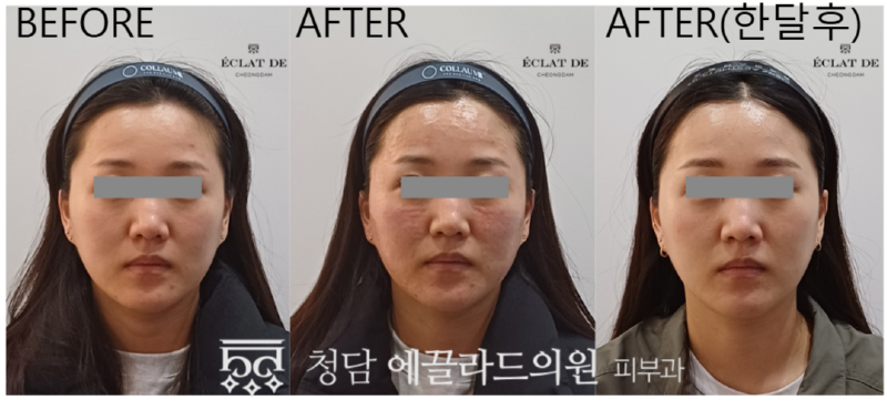 스크린샷_2025-04-08_164058.png